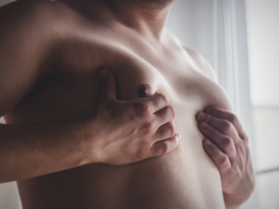 Gynecomastia